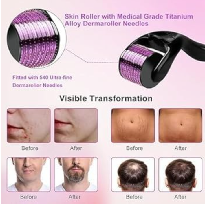 Derma Roller 0.25mm - Microneedling Tool for Face & Beard Growth