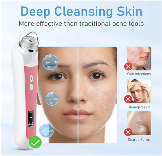 Electric Blackhead Remover Vacuum - Pore Cleaner with HD Camera
