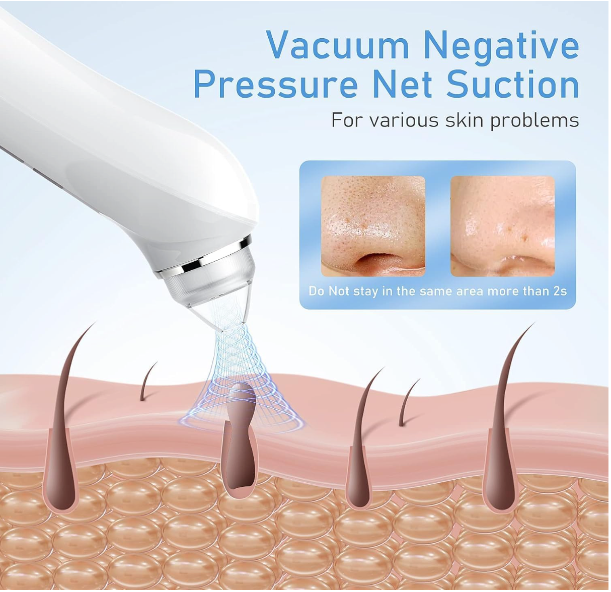 Electric Blackhead Remover Vacuum - Pore Cleaner with HD Camera