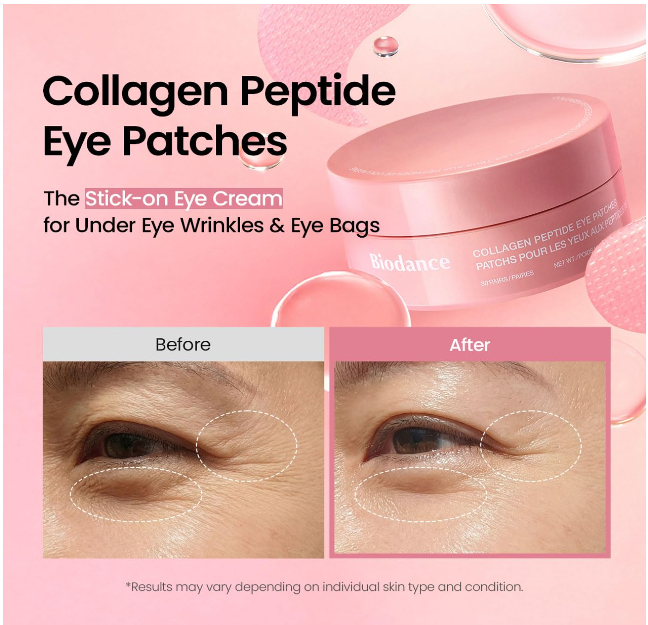 Collagen Under Eye Patches - 60 Pcs Anti Dark Circles & Puffiness